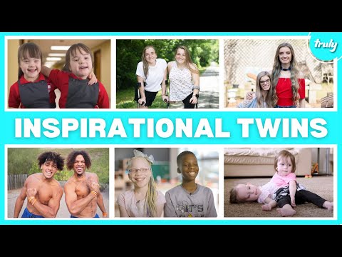 8 Of The Most Unique Twins In The World | BORN DIFFERENT