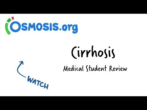 Cirrhosis Overview | Clinical Presentation