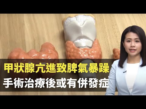 甲狀腺亢進致脾氣暴躁   手術切除治療後或有併發症 - 最強生命線 - 香港新聞 - TVB News- 黃靖婷