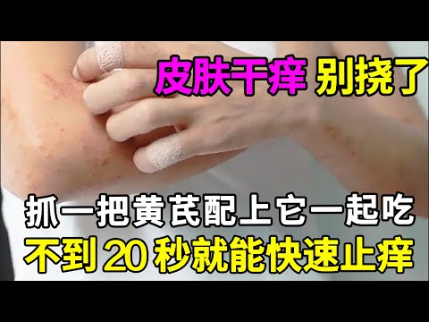 皮肤又干又痒，抓破皮肤也不止痒的人，抓一把黄芪配上它一起吃，不到20秒立马快速止痒，再也不用把皮肤抓烂了！【养生早知道】