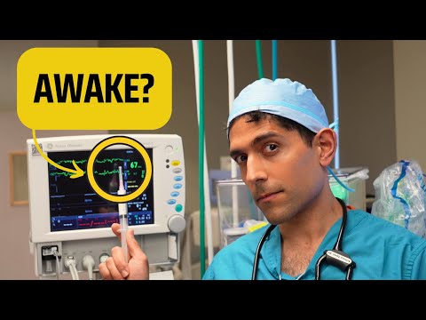 How To Tell If A Patient Is Awake Under Anesthesia? (And What To Do)