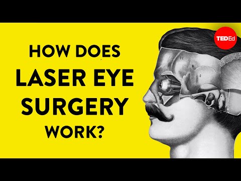 How does laser eye surgery work? - Dan Reinstein