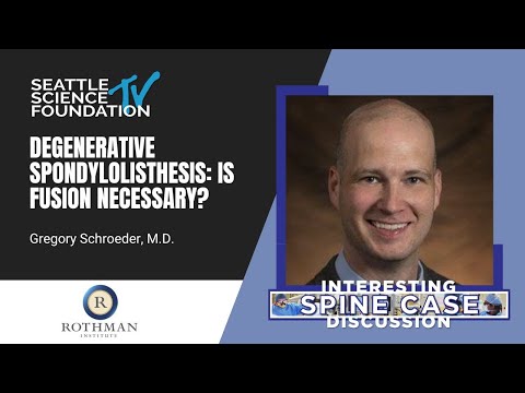Degenerative Spondyloltitheis: Is Fusion Necessary? – Gregory Schroeder, MD