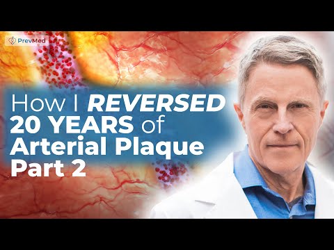 How I Reversed My Arterial Age 20 years (Part 2): My Scores