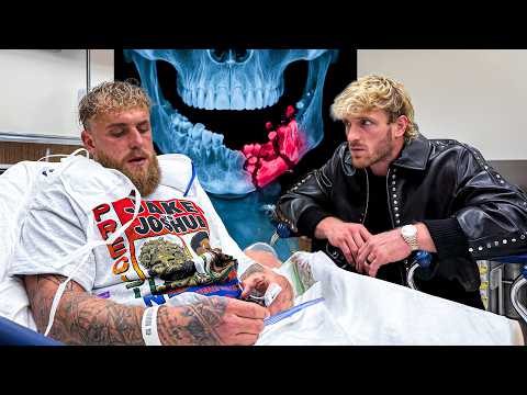 Anthony Joshua Broke My Brother’s Jaw