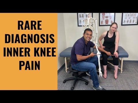 This Rare Diagnosis Is Easily The Biggest Reason For Inner Knee Pain