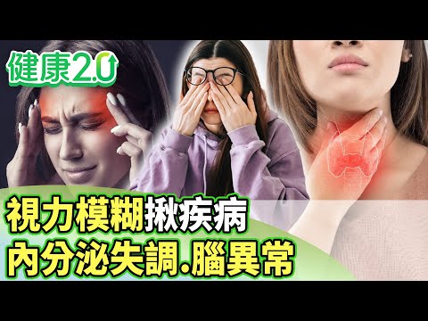 視力模糊揪疾病！內分泌失調、腦異常、免疫疾病【健康2.0分段】@tvbshealth20  EP3137-3 20251207 #陳欣湄#韋汝#徐浩恩#柳朋馳#趙函穎#鄒瑋倫#彥寬