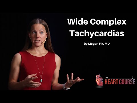 Wide Complex Tachycardias | The Heart Course