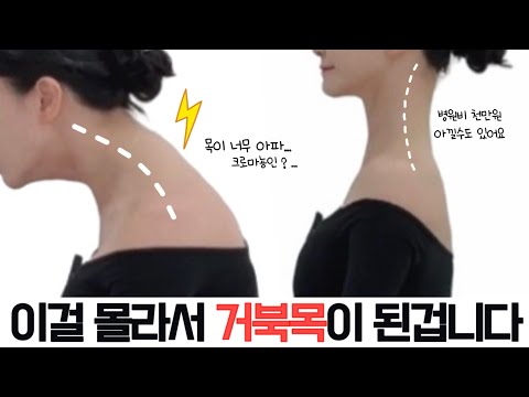 [Just 10 minutes🔥] 99% of people don't know about the turtle neck correction method. If you sit "...