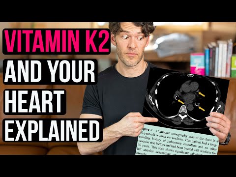 Vitamin K2, Heart Health & Arterial Calcification: Must Know Details