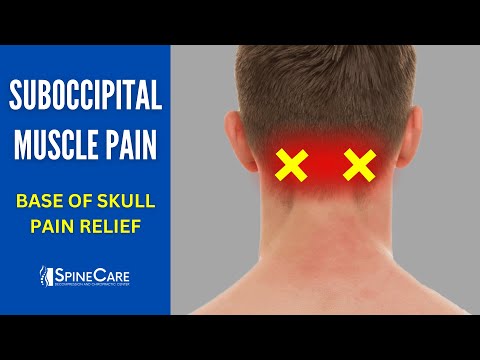 How to Fix Suboccipital Muscle Pain | BASE OF SKULL Pain Relief