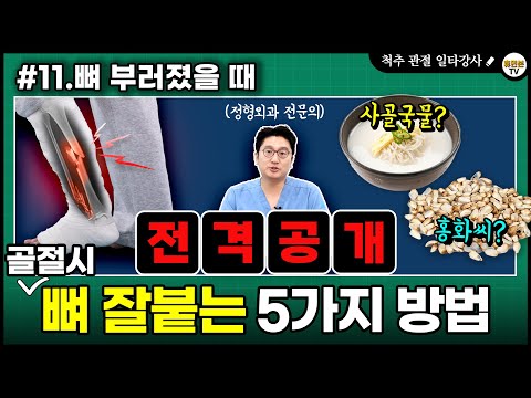 골절시, 뼈 잘붙는 5가지 방법 (사골국물, 홍화씨)  l  휴먼본TV 일타강사