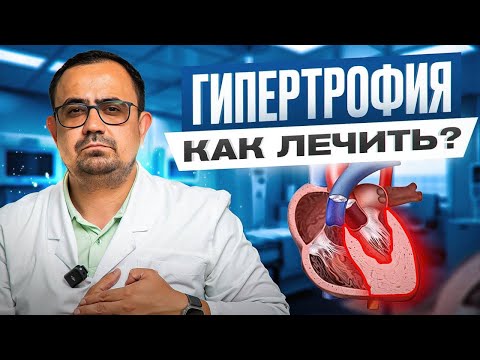 Чем ОПАСНА гипертрофия левого желудочка? Признаки, лечение, прогноз жизни