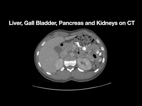 Anatomy of the Liver, Gall Bladder, Pancreas and Kidneys on CT