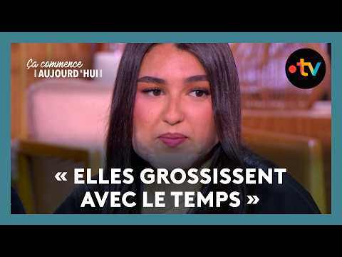 Inès souffre de chéloïdes depuis ses 13 ans - Ça commence aujourd'hui