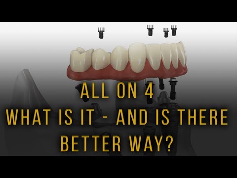 All on 4 - Is there a better way?