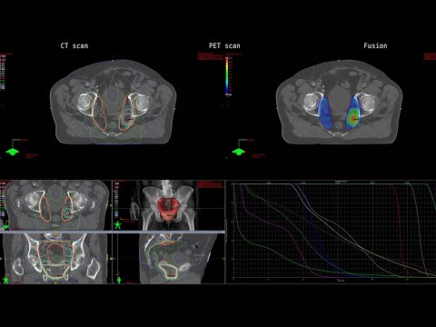 OTT: FACBC: The Story