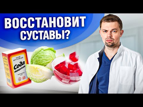 Как ПРАВИЛЬНО лечить артроз дома? Соблюдай ЭТИ 5 ПРАВИЛ…