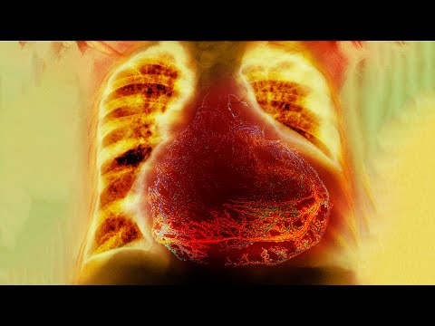 A Man Lost 20 Pounds In 9 Hours And It Ruined His Life