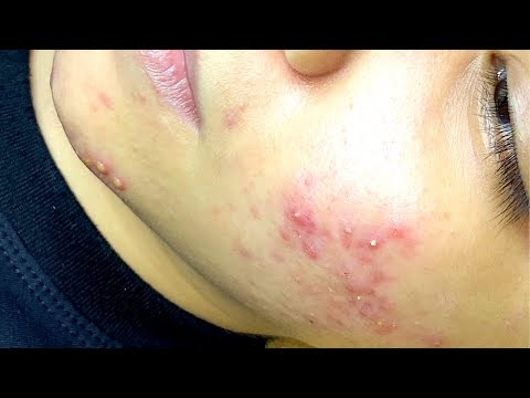 Relax Every Day With Sac Dep Spa #0066