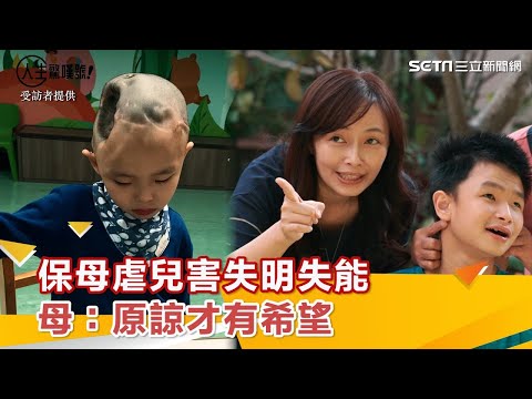 保母虐慘2歲兒！右腦切除害失明失能　母：我原諒保母　全家才有希望｜祝你健康
