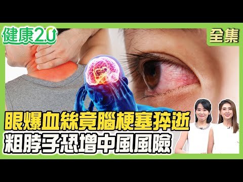33%有頸動脈斑塊 視線模糊小心腦梗致命！日本男星左眼爆血絲竟腦梗塞2天猝逝！粗脖子中風風險高3倍！健康2.0 20250921【完整版】#陳欣湄#韋汝#袁明琦#顏君霖#沈瑞斌#胡逸惟#陸巧因