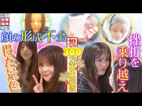 【ザ！世界仰天ニュース】「普通の顔になりたい」挫折を乗り越えた今の景色