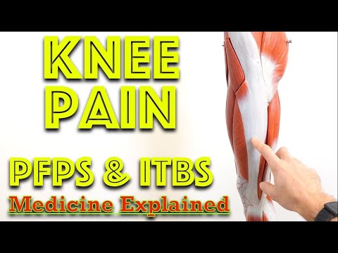 Knee Pain Diagnosis: PFPS or ITBS? Patellofemoral pain syndrome vs Iliotibial band Syndrome