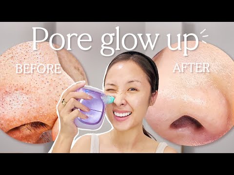 My weekly PORE glow up: how I unclog large pores & texture 👃 (ft Shark FacialPro Glow)