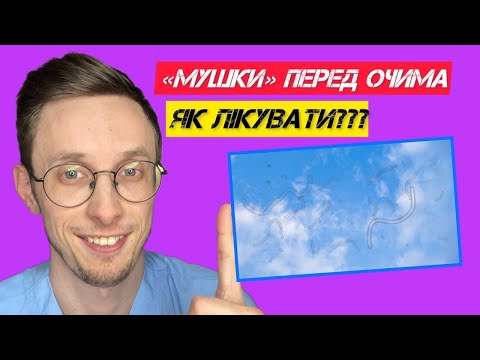 "МУШКИ" перед очима - причини і як лікувати?