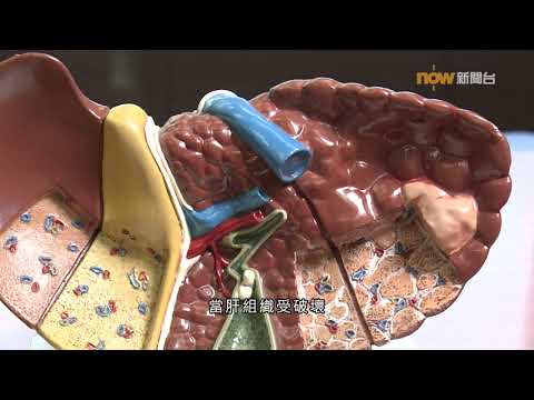 【杏林在線】肝炎與癌症的距離