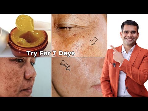 Best Cream To Remove Pigmentation, Blemishes Dark Spots - Dr. Vivek Joshi