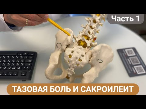 WHY DOES THERE HURT IN THE PELVIC AREA? SACROILITIS. (Part 1)