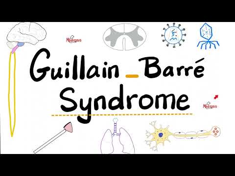 Guillain-Barré Syndrome - Acute Inflammatory Demyelinating Polyradiculoneuropathy “AIDP”- Neurology