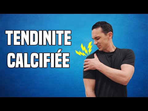 TENDINITE CALCIFIANTE DE L'ÉPAULE : EXERCICES ET TRAITEMENTS KINÉ