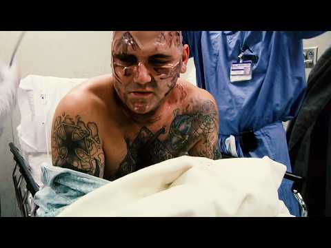 25 Surgeries to Remove His Neo-Nazi Tattoos | Erasing Hate