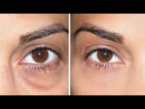How to Cover Dark Circles + Under Eye Bags