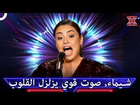 صوت من اقوى الاصوات التي اخترقت قلوب الملايين - اكس فاكتور الموسم 1