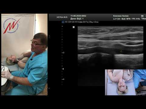 Стандарт УЗИ экстракраниальных БЦС (профессор Куликов В.П.)