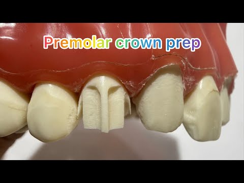 🦷✨ Step-by-step Maxillary Premolar Crown Preparation | Dr.Dentique-hub