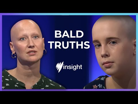 From full hair to bald in 6 months | SBS Insight