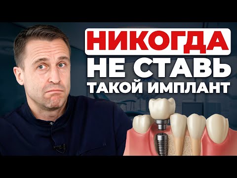 All types of DENTAL IMPLANTS in 1 video! Which implant to choose in 2026?