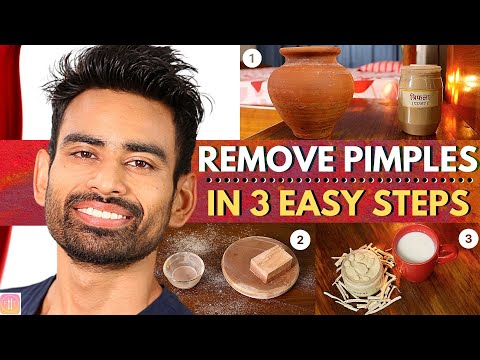 ULTIMATE Ayurvedic Routine to Get Rid of Pimples & Acne Permanently (Men & Women)