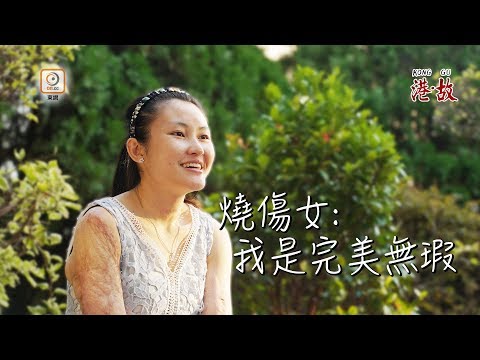 港故：烈火燒不滅鬥志　捱過40次手術重生
