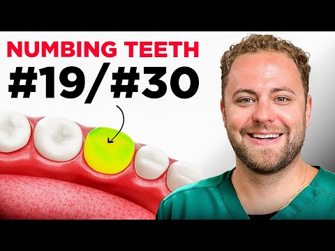Say Goodbye to Anesthesia Fails: Proven Techniques for Numbing Mandibular Molars