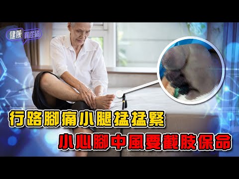 行路腳痛小腿掹掹緊 小心腳中風要截肢保命 ｜ 健康關注組 ｜ EP445 ｜ 腳中風 ｜ 動脈粥狀硬化 ｜ 膽固醇 ｜ 截肢 ｜ 吳雲甫 ｜ 麥詩敏 ｜ HOY TV 77台