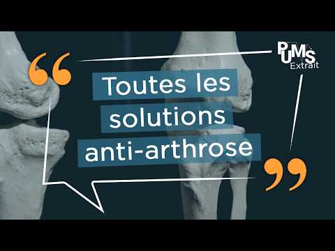SOIGNER l’ARTHROSE : c’est vraiment POSSIBLE ? On vous dit tout !
