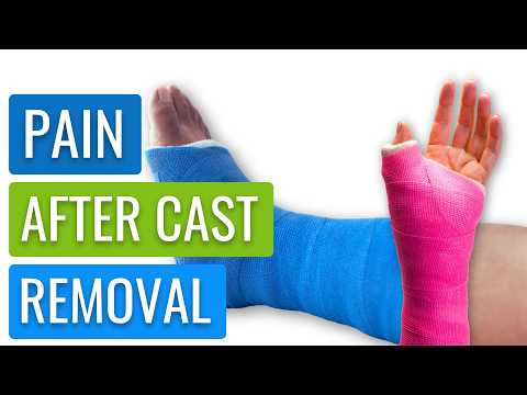 Pain After Cast Removal? How to Reclaim Your Limb Physically and Mentally