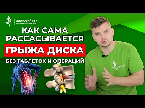 How a herniated disc resolves on its own without pills or surgery