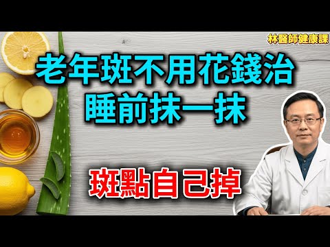 老年斑不用花錢治！醫生揭秘：廚房裡“天然祛斑王”，睡前抹一抹，斑點淡得快，比激光還安全！